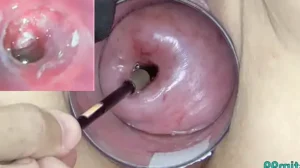 Mature Milf Cervix Play with Endoscope Japanese Cam into Uterus